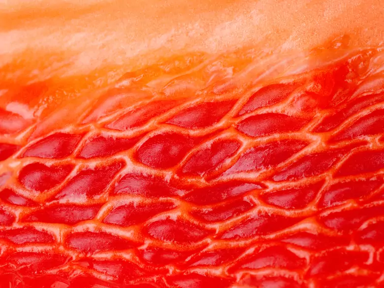 Rak pochwy – informacje dla pacjentek