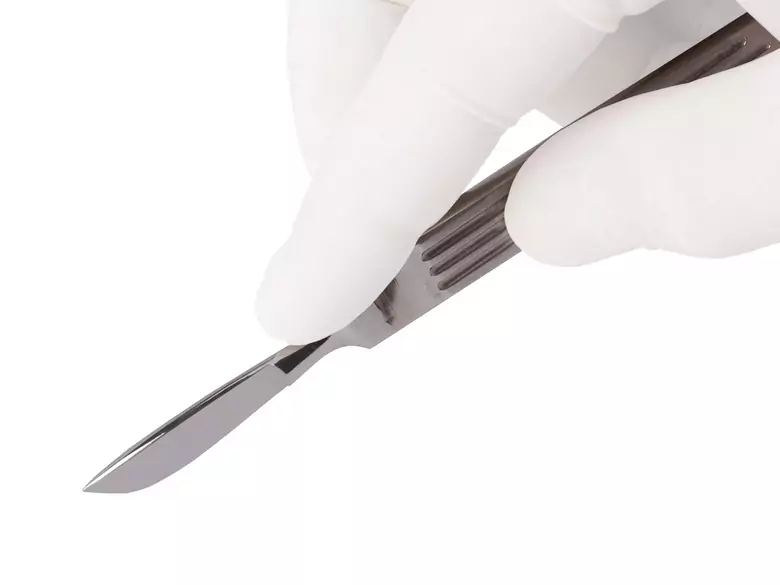 Amputacja szyjki macicy jako możliwość zachowanie płodności u kobiet z rakiem szyjki macicy.