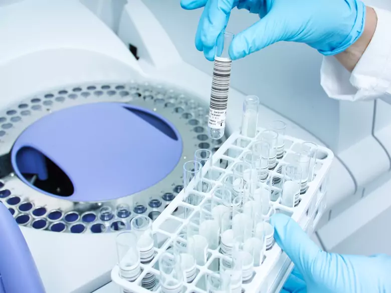 Diagnostyka niepłodności – badania hormonalne