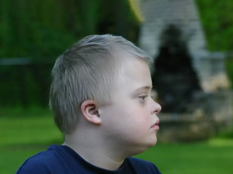 Wykrywanie zespołu Downa w przypadku ciąży bliźniaczej.