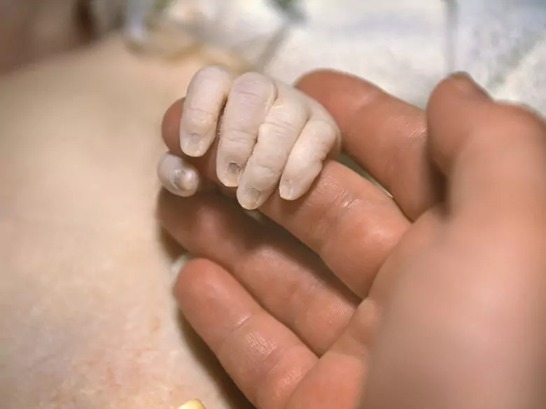 Uszkodzenia płodu wynikające z niedotlenienia i niedokrwienia.