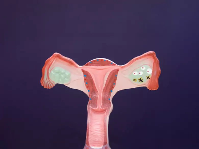 Ciąża będąca wynikiem spontanicznej owulacji u kobiet z jawnym przedwczesnym wygasaniem czynności jajników.