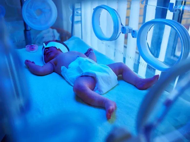 Wcześniactwo a śmiertelność: poznaj czynniki, które mogą zagrażać życiu Twojego dziecka